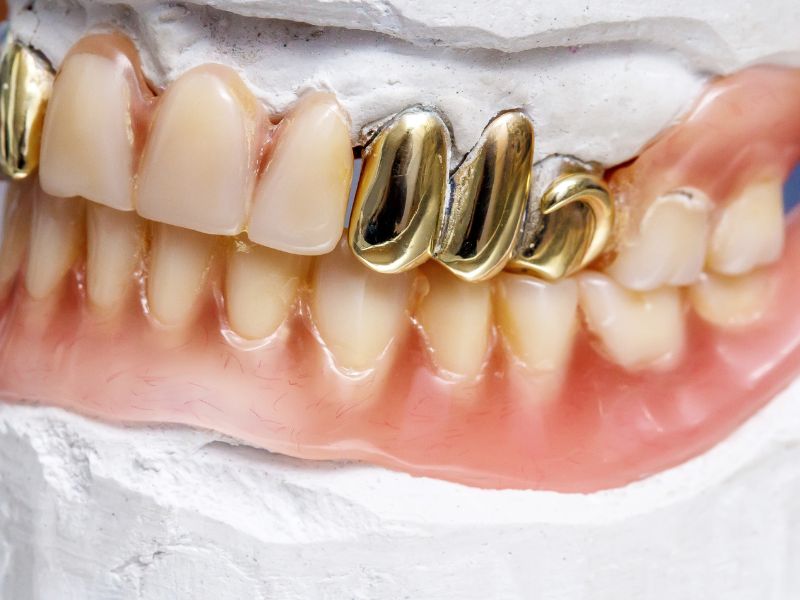 antiquitaeten-ankauf-verkauf-berlin-Gold-und-Silber-Edelmetall-Glas-Silber-wohnungsaufloesung-handel zahngold 2